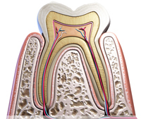 自分の歯を残すための根管治療