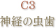 C3 神経の虫歯